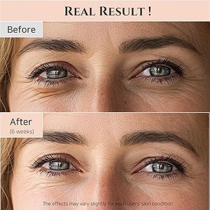 Beauty of Joseon Revive Eye Serum – Ginseng + Retinal | Anti-Aging Eye Care